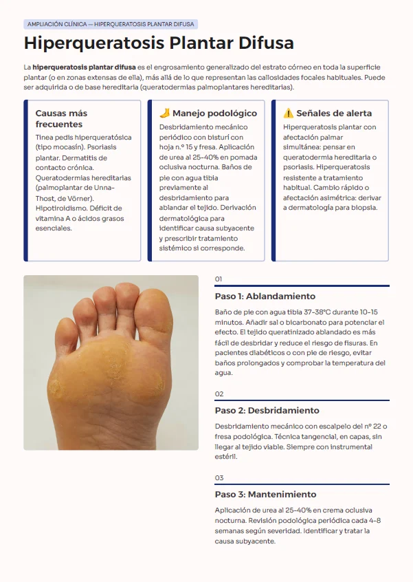 Página de la guía: hiperqueratosis plantar difusa, con causas, manejo podológico y protocolo paso a paso